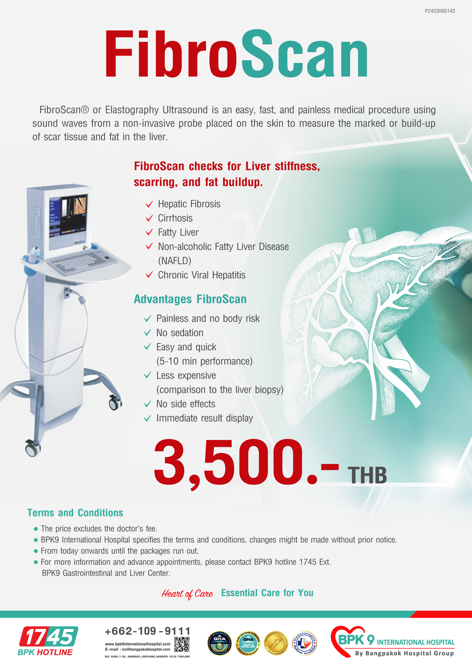 FibroScan